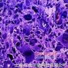 Bel-7402人肝癌细胞图1